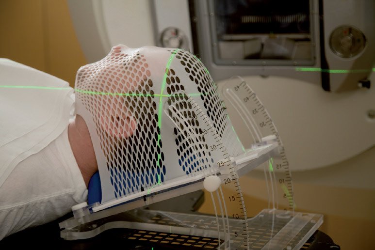 Radioterapia contro il cancro - Fondazione Ospedale Alba-Bra